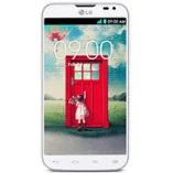 LG L70 D325F